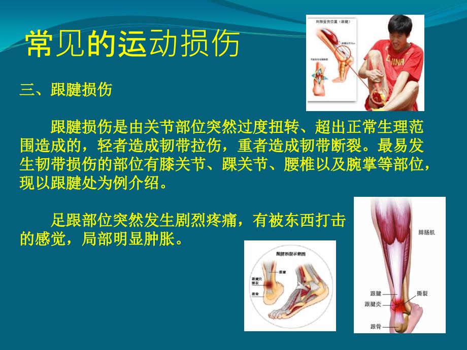 常见损伤的应急处理与急救.ppt_第4页