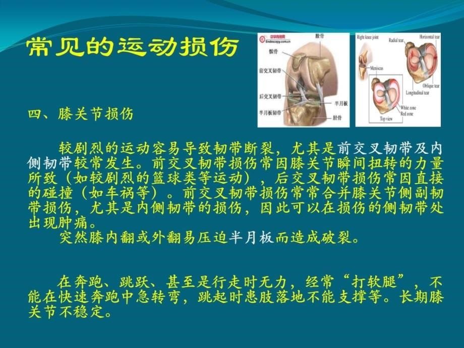 常见损伤的应急处理与急救.ppt_第5页