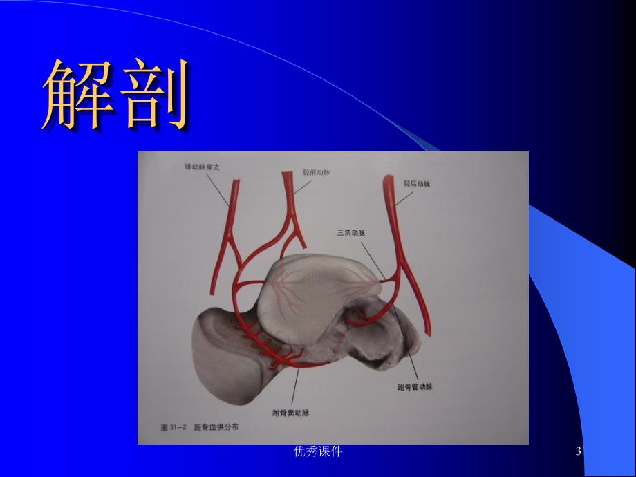 距骨骨折课件【医疗资料】_第3页