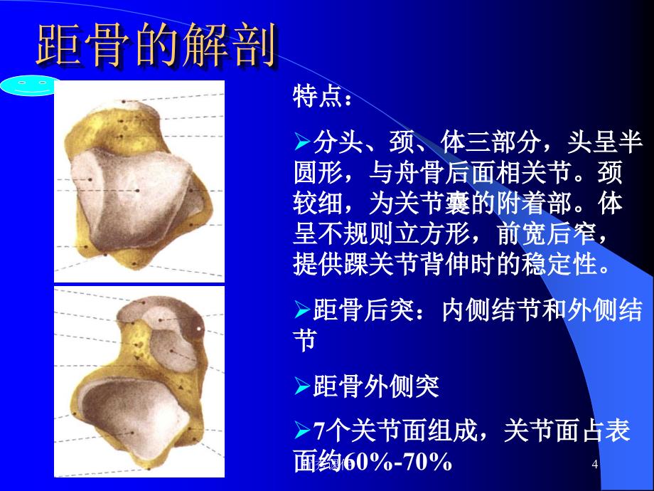 距骨骨折课件【医疗资料】_第4页