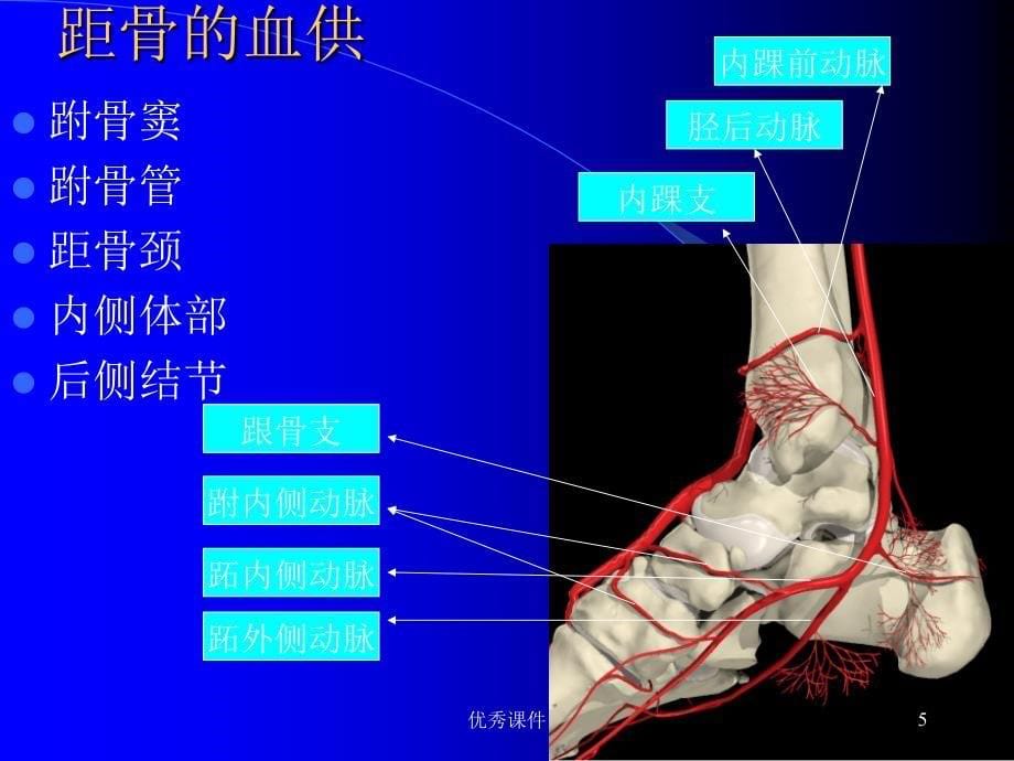 距骨骨折课件【医疗资料】_第5页