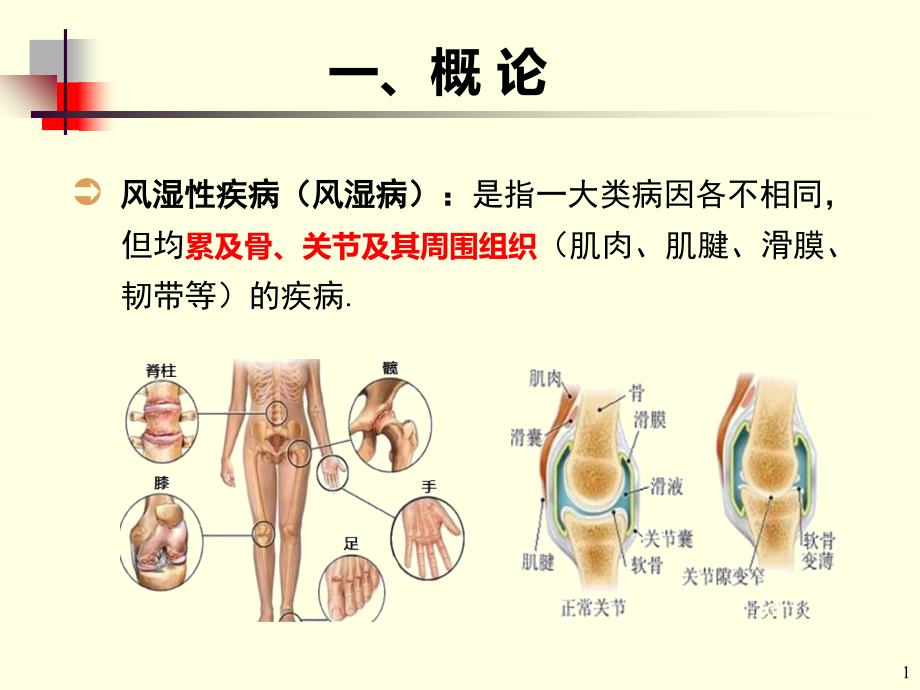 风湿概述文档资料_第1页