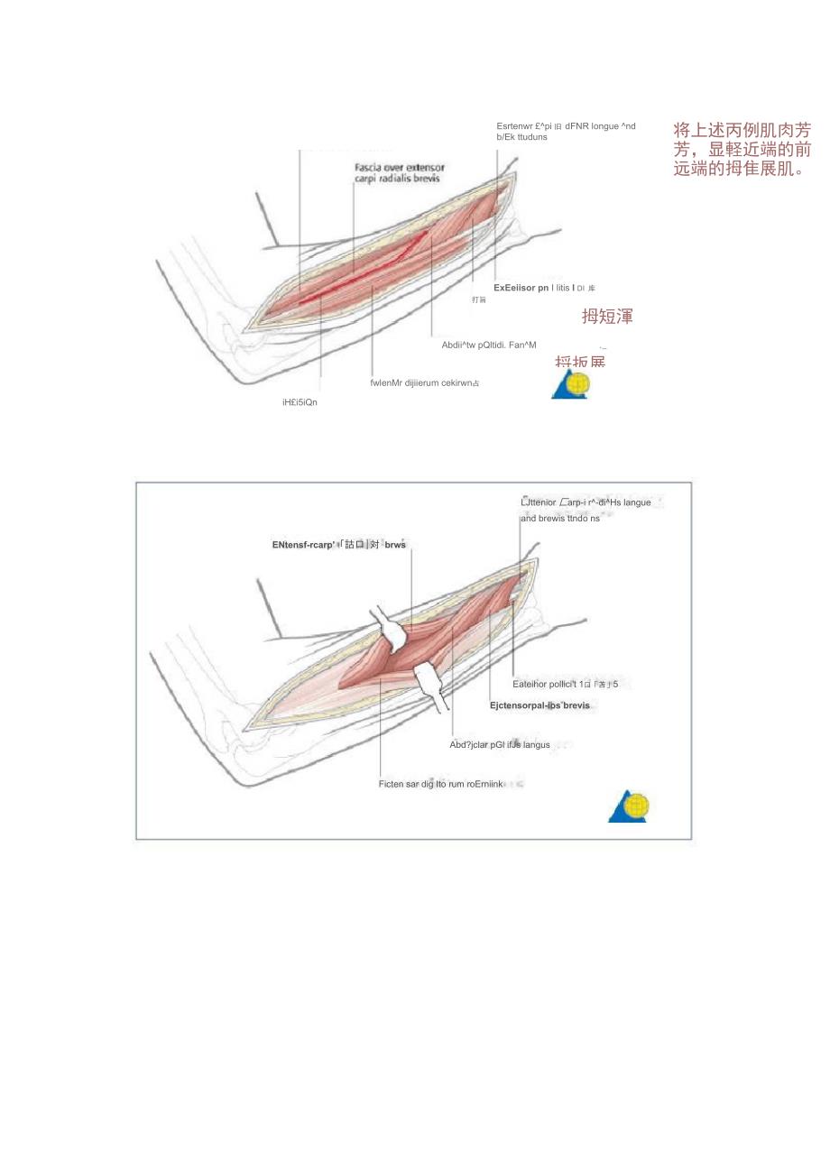 桡骨背外侧手术入路_第2页