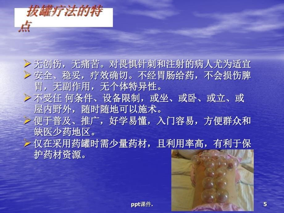 刮痧拔罐蜡疗法ppt课件_第5页