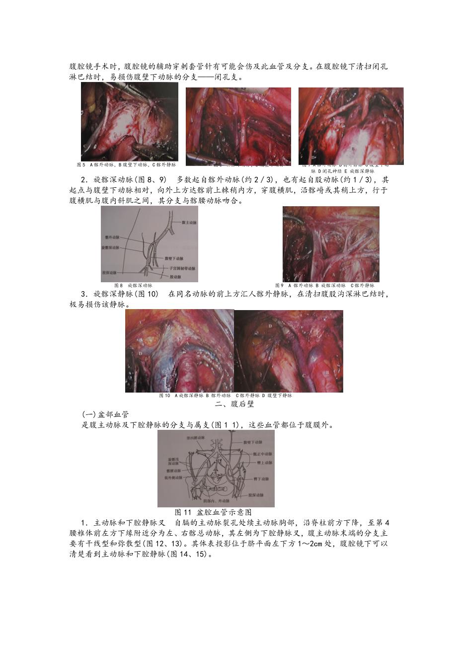 妇科腹腔镜手术相关腹部解剖.doc_第2页