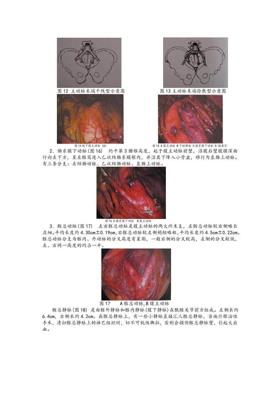 妇科腹腔镜手术相关腹部解剖.doc_第3页