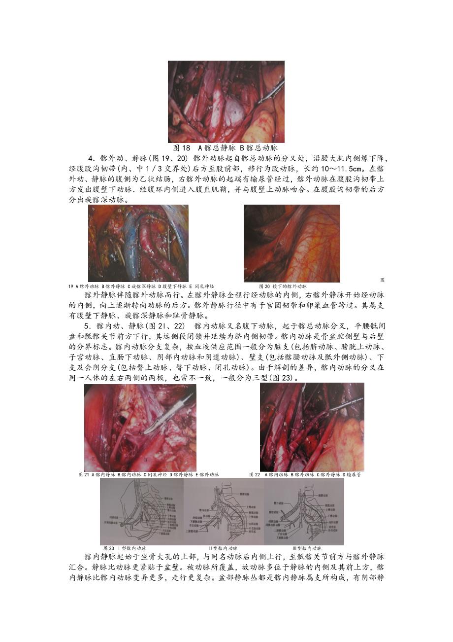 妇科腹腔镜手术相关腹部解剖.doc_第4页