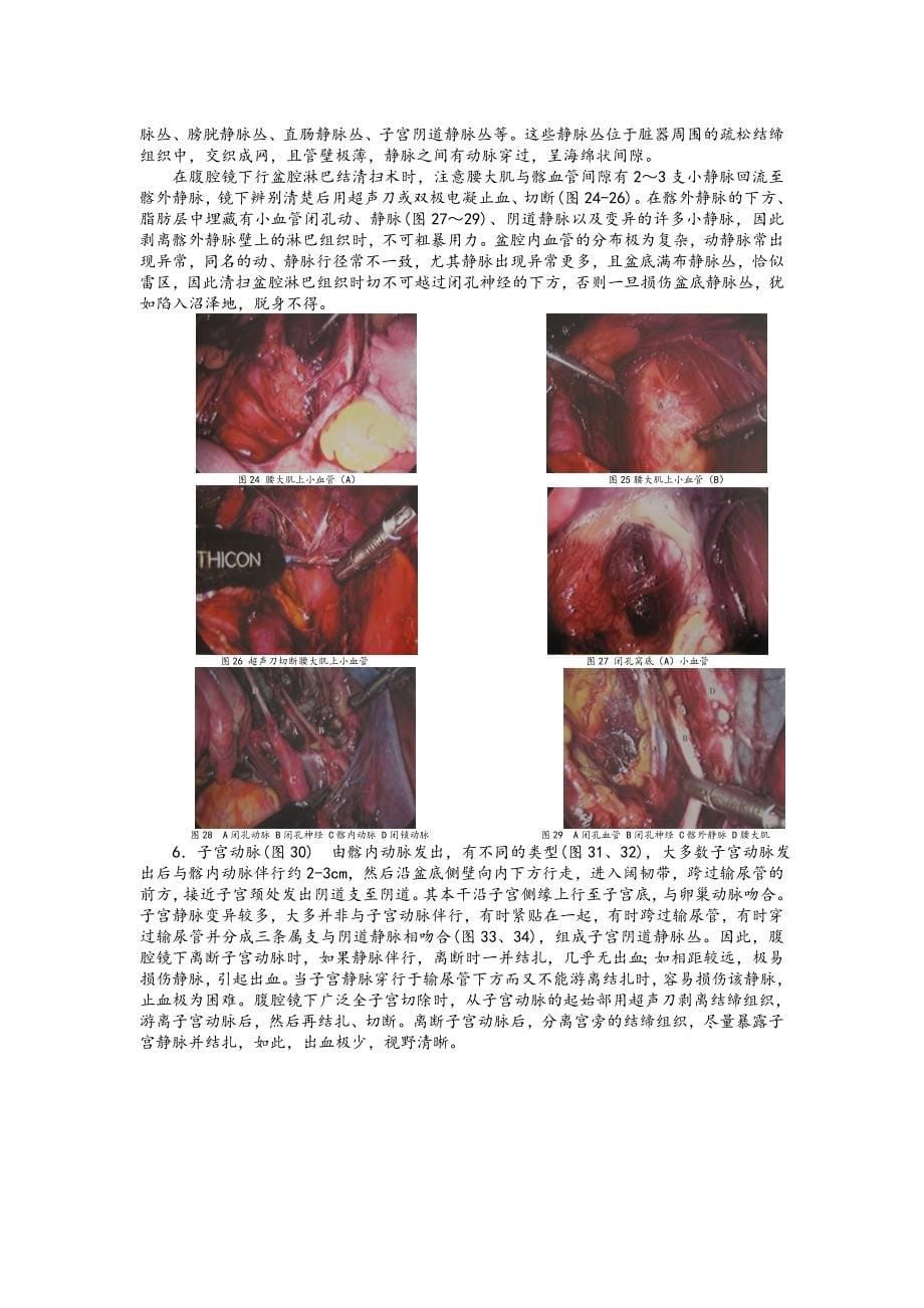 妇科腹腔镜手术相关腹部解剖.doc_第5页