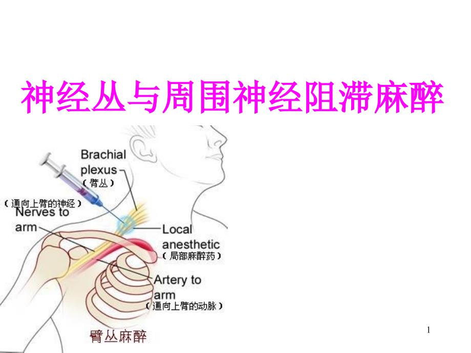 讲课稿：周围神经阻滞麻醉ppt参考课件_第1页