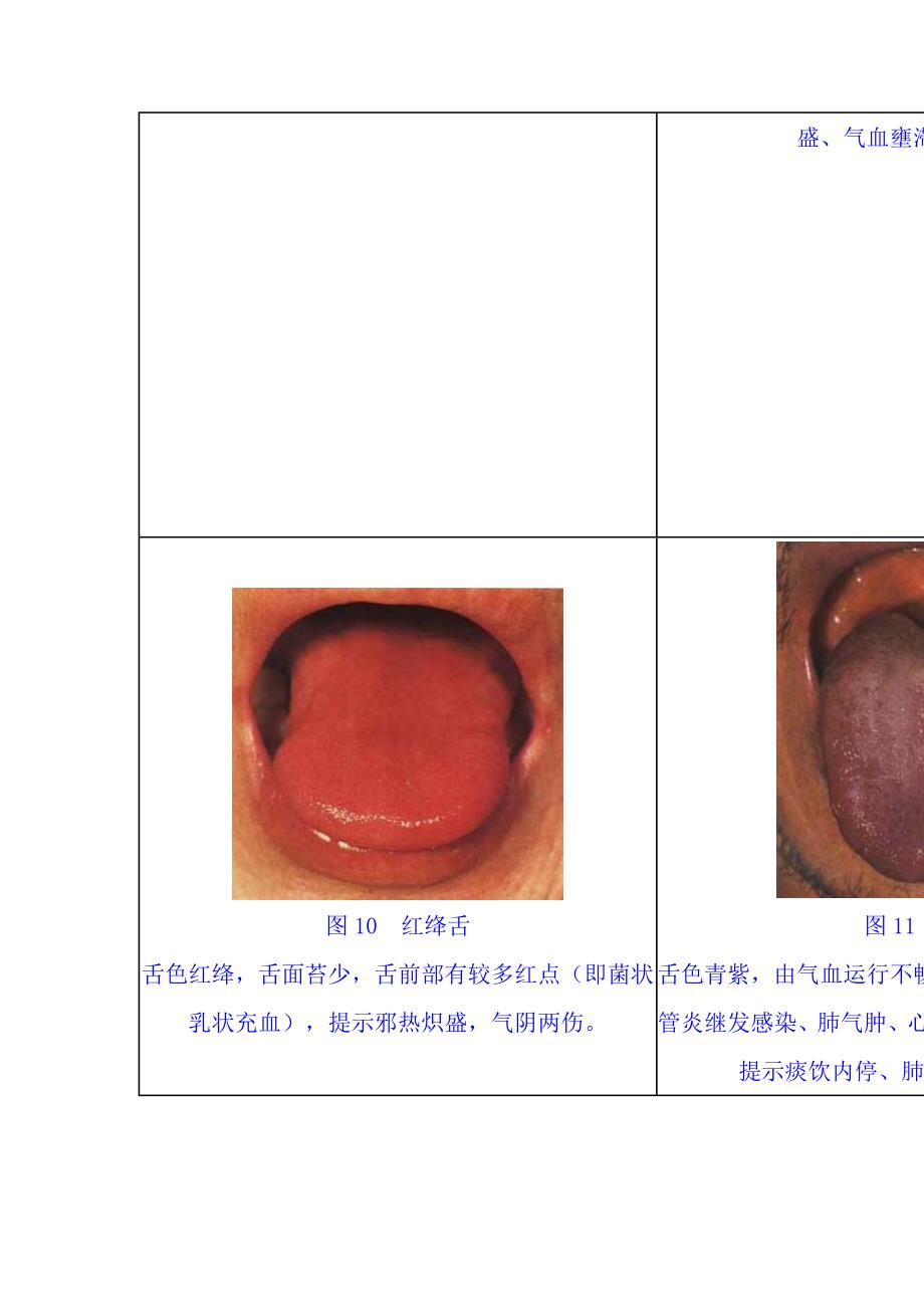 舌苔望诊图谱集_第3页