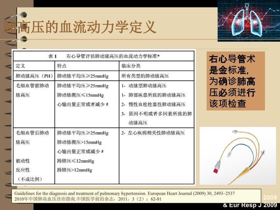 肺动脉高压与右心导管检查.ppt_第5页