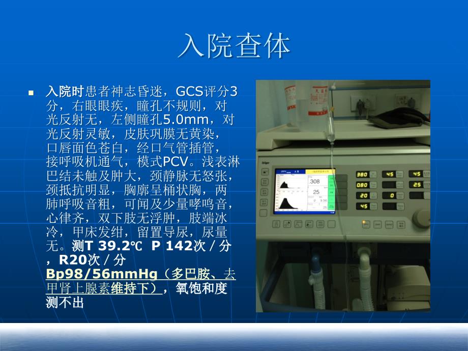 教学查房感染性休克课件_第4页