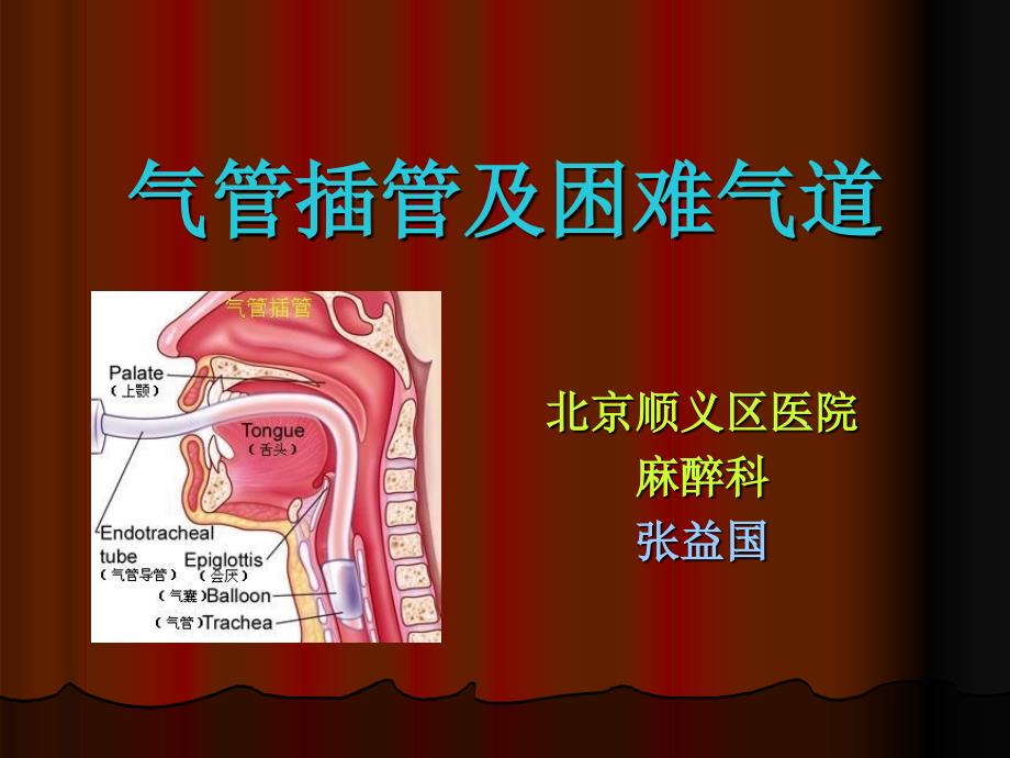 气管插管术 PPT课件.ppt_第1页