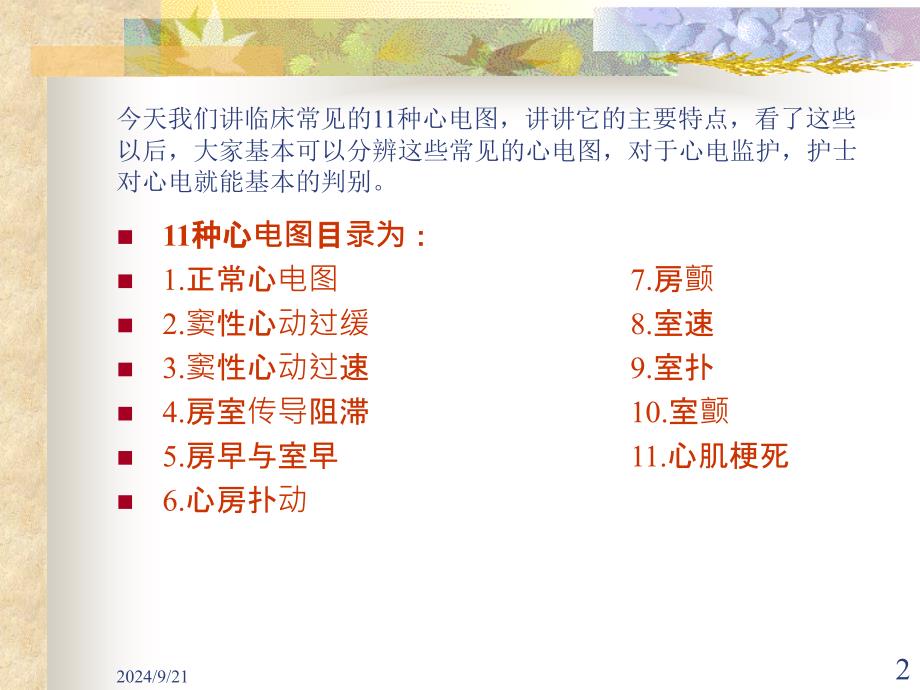 临床常见的11种心电图PowerPoint 演示文稿_第2页