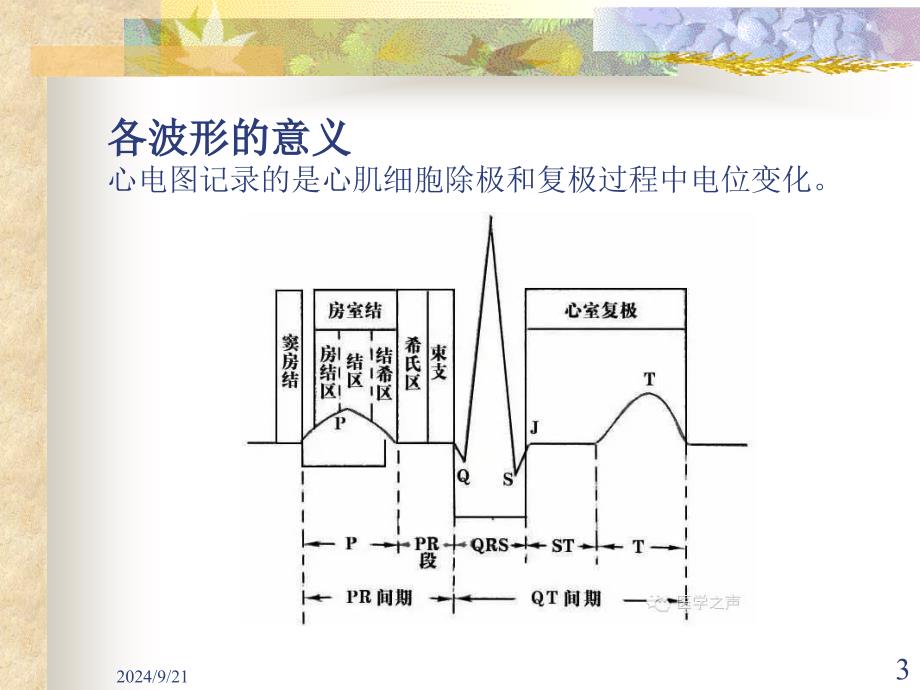 临床常见的11种心电图PowerPoint 演示文稿_第3页