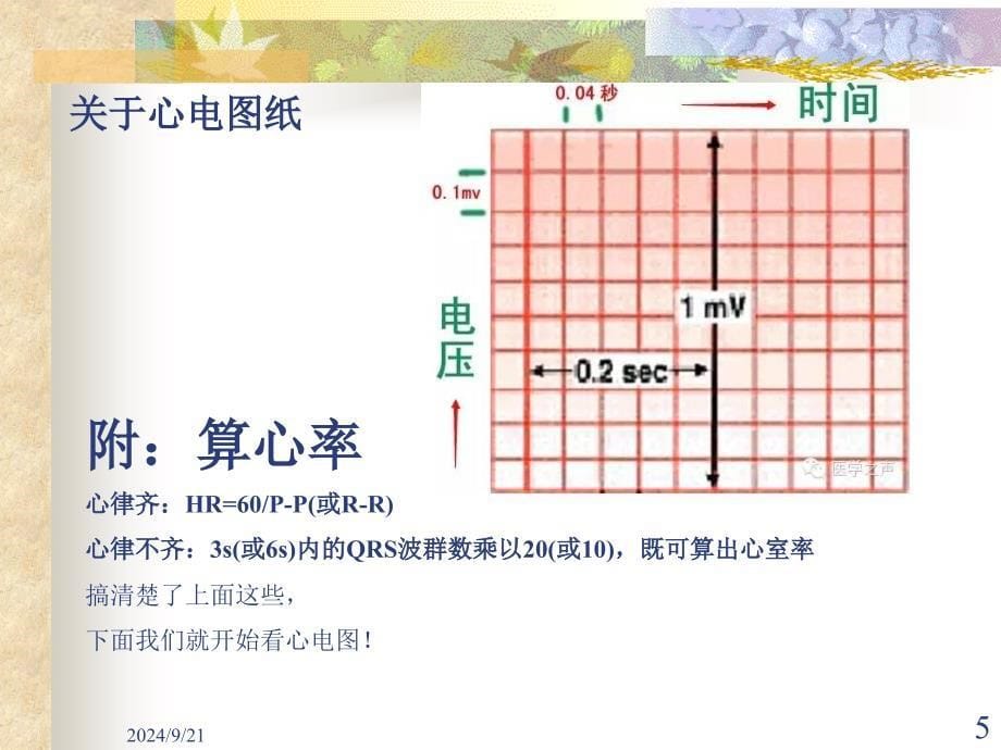 临床常见的11种心电图PowerPoint 演示文稿_第5页