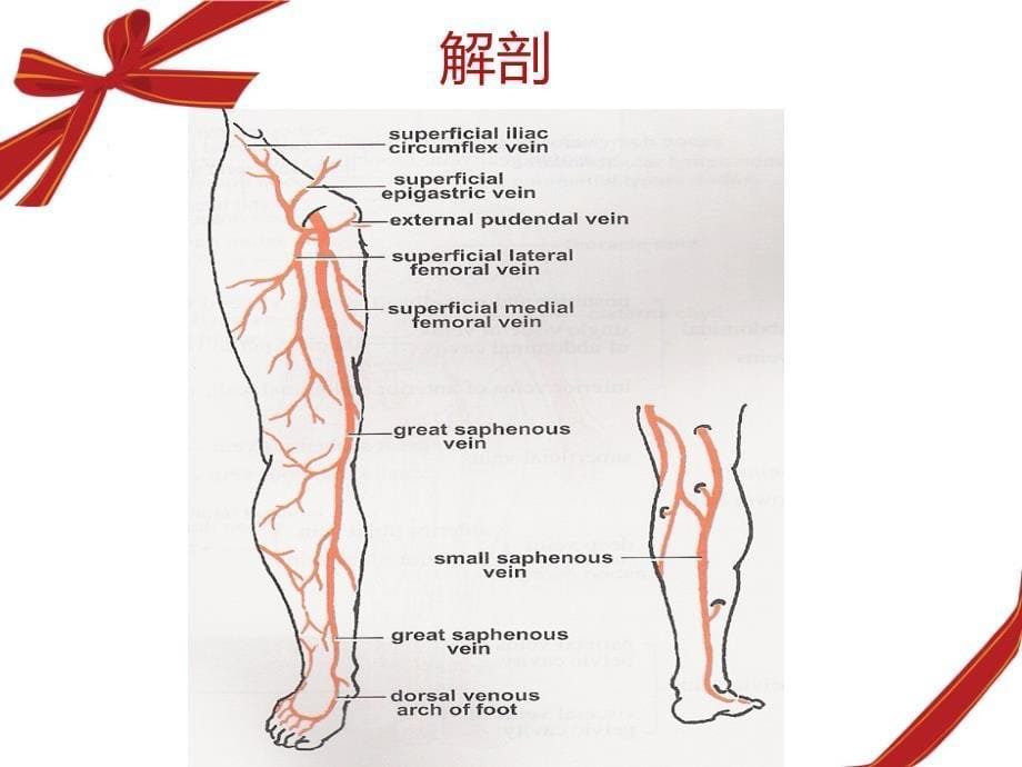 下肢静脉功能不全课件_第5页