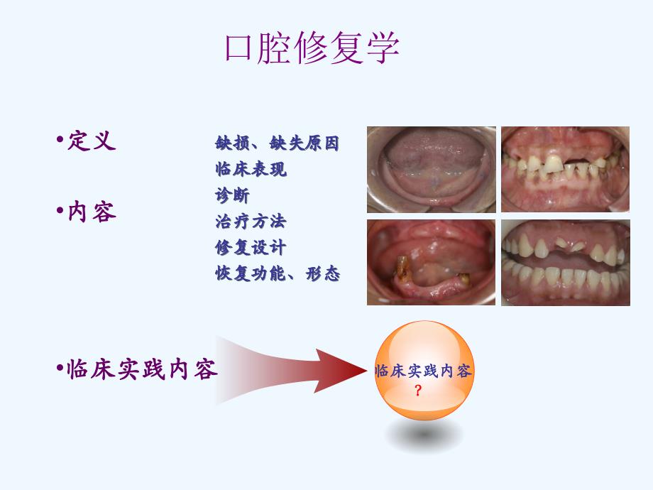 口腔修复学(55页）_第3页