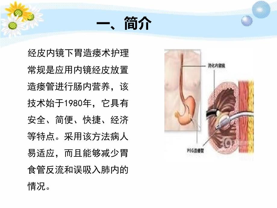 （精选课件）经皮内镜下胃造瘘术护理常规_第3页