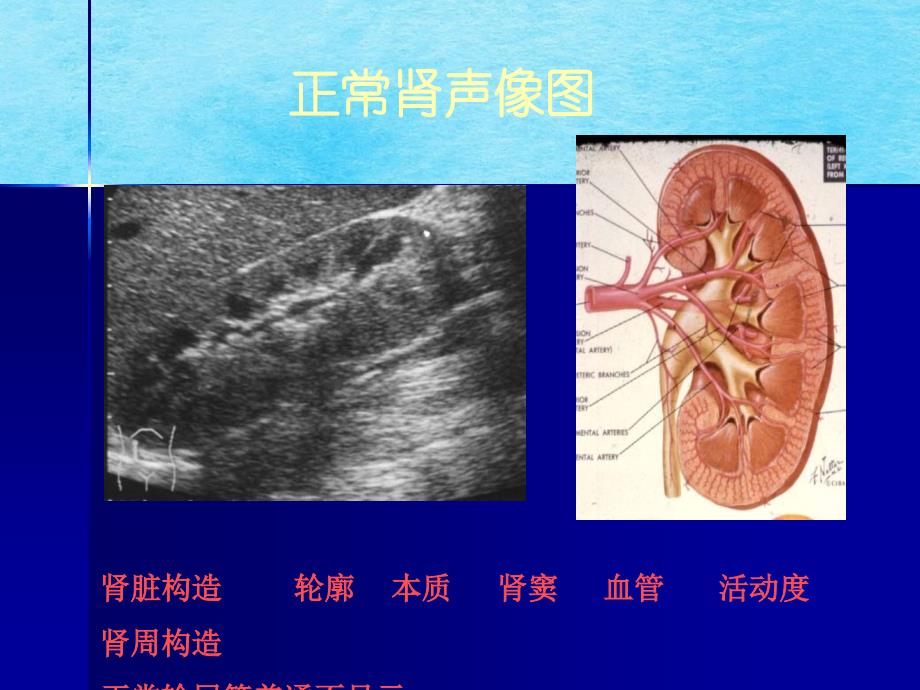 泌尿系疾病超声诊断朱家安上海交通大ppt课件_第4页