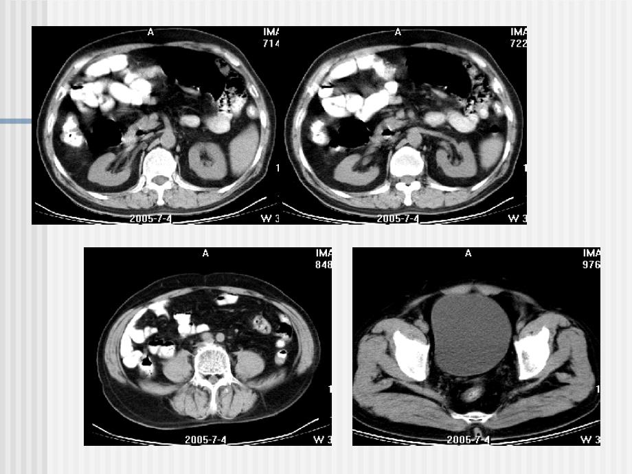 泌尿系统CT检查PPT课件_第3页