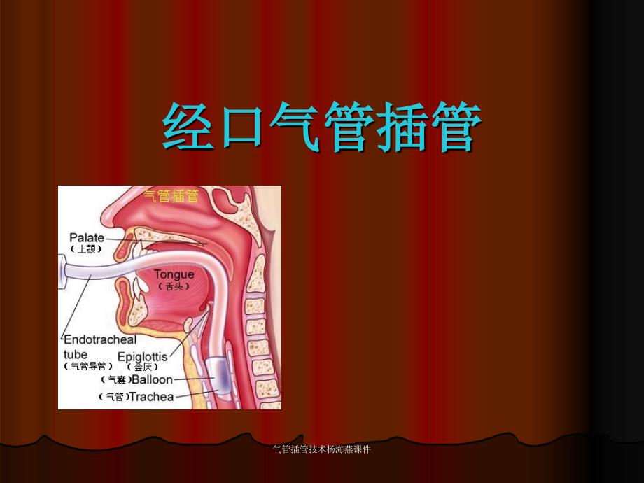 气管插管技术杨海燕课件_第1页