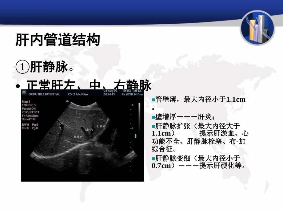 肝脏超声图片PPT课件_第5页