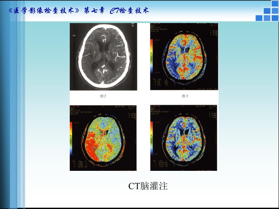 CT检查的适应证与禁忌证课件_第4页