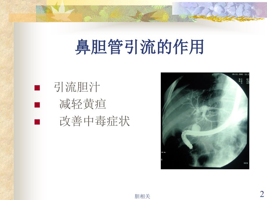 鼻胆管引流术护理【肝胆知识】_第2页