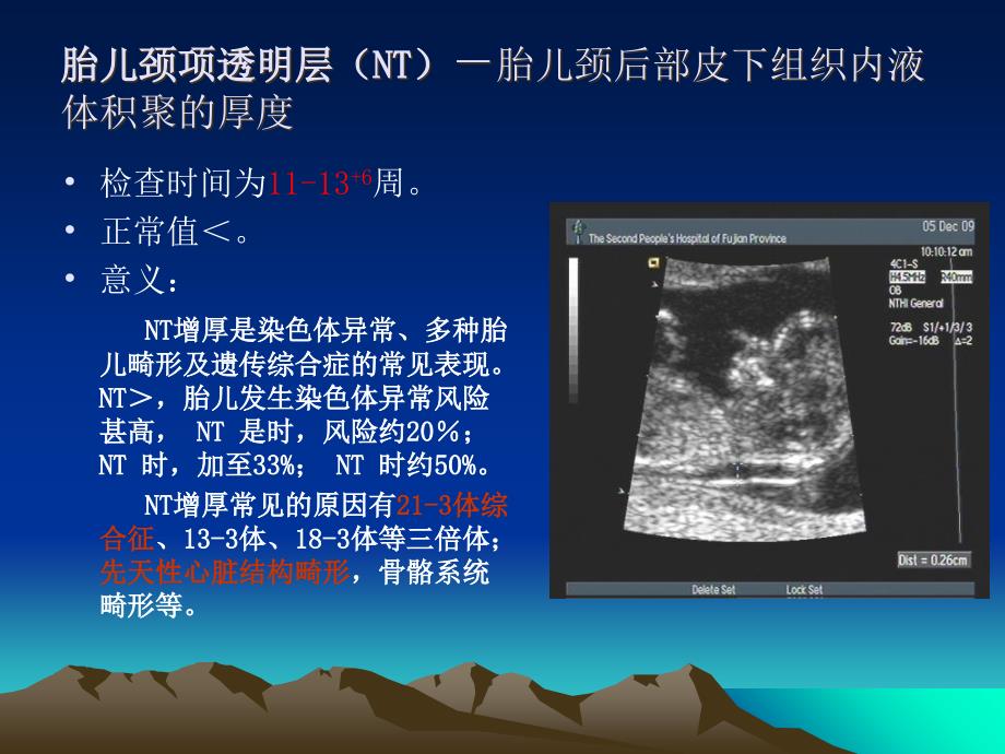 产科超声检查指标PPT课件_第4页