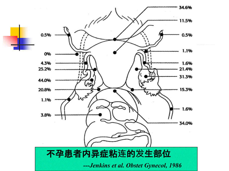 子宫内膜异位症与不育-田秦杰_第3页