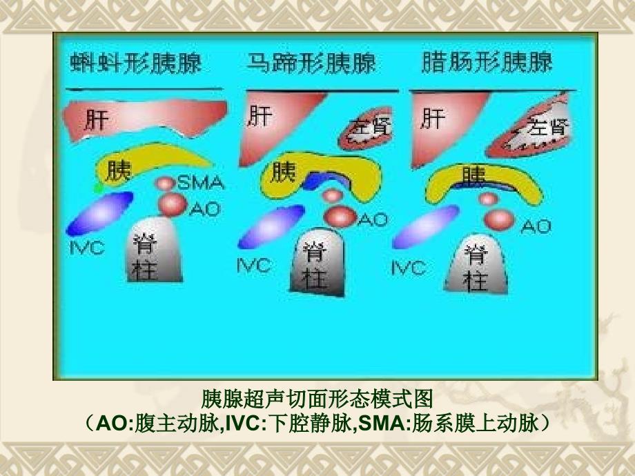 医学胰腺疾病超声诊断PPT培训课件_第4页