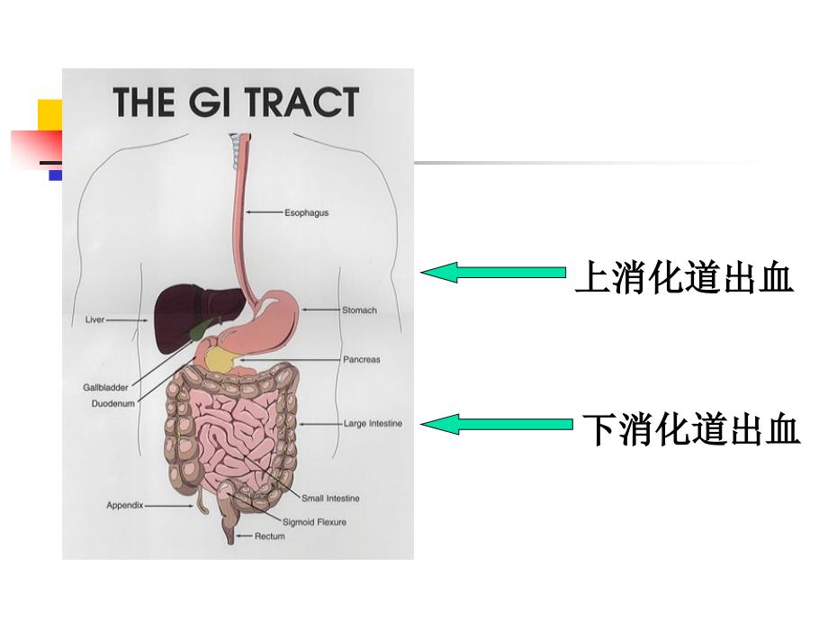 第十一节上消化道大出血课件_第2页