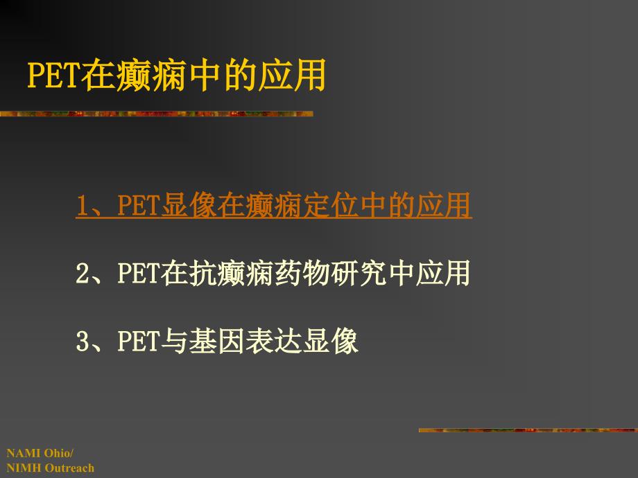 《癫痫的PET显像》PPT课件.ppt_第4页