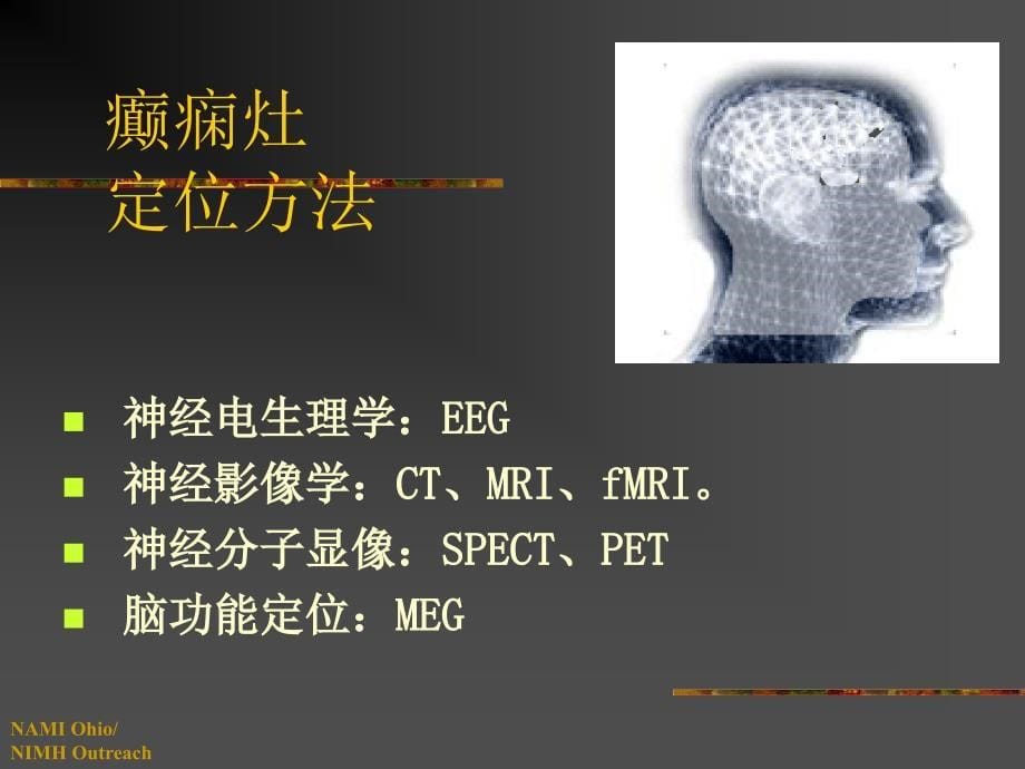 《癫痫的PET显像》PPT课件.ppt_第5页