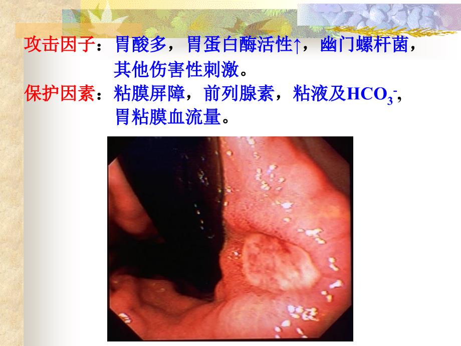 抑制胃酸分泌PPT课件_第3页