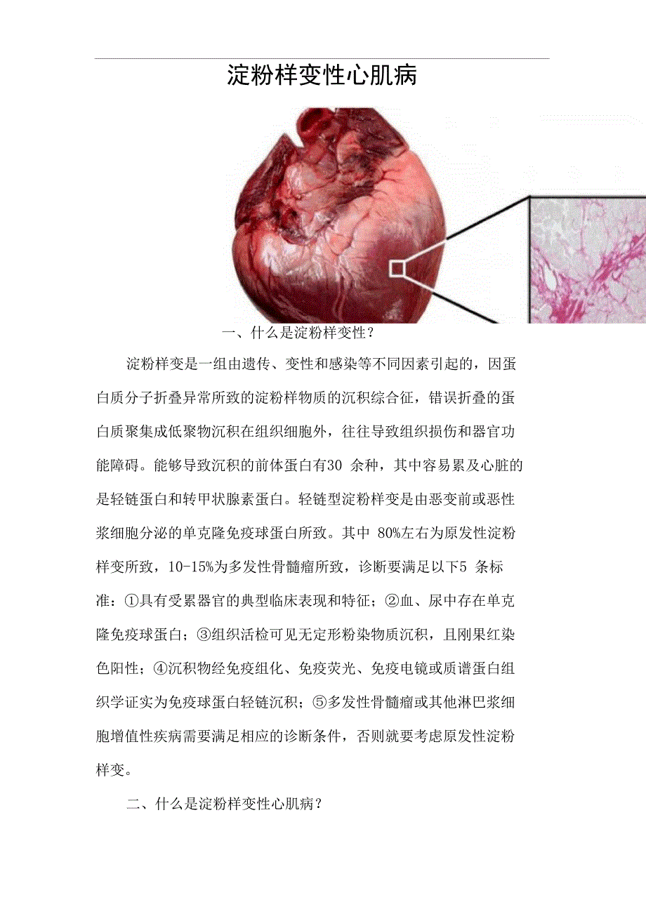 淀粉样变性心肌病_第1页