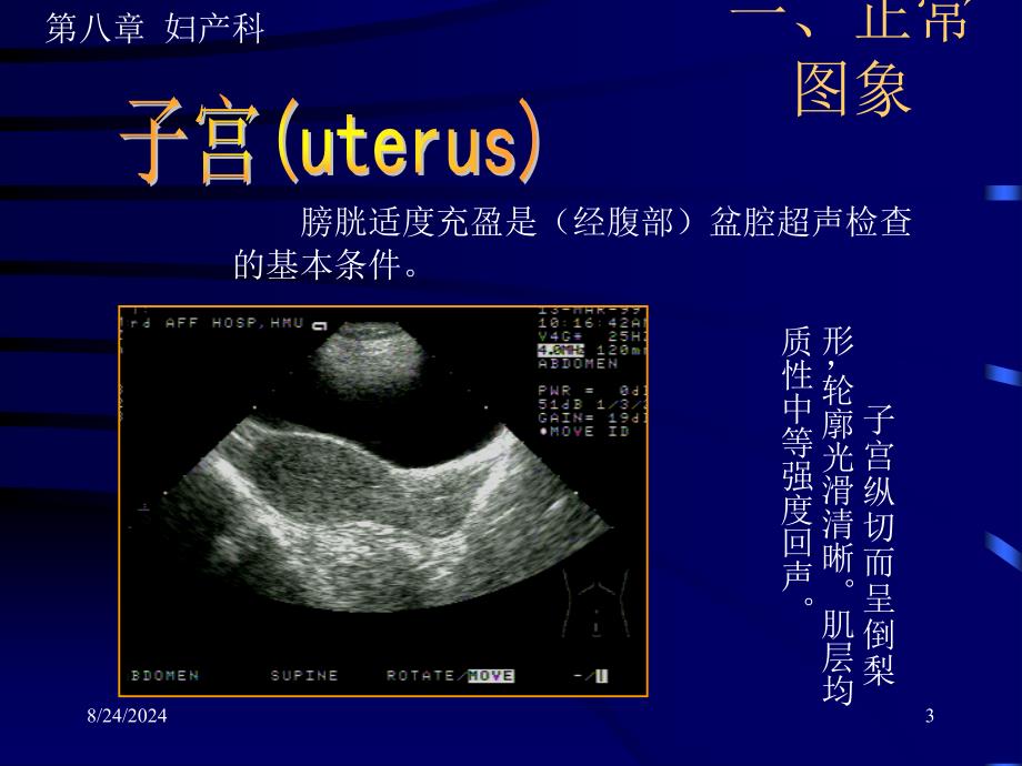 《妇产超声》PPT课件.ppt_第3页