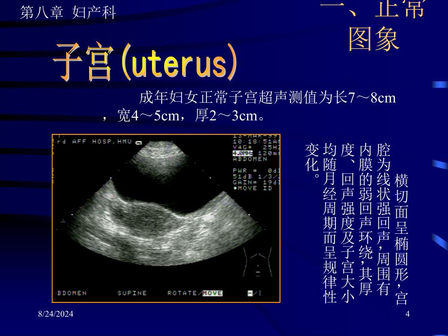 《妇产超声》PPT课件.ppt_第4页