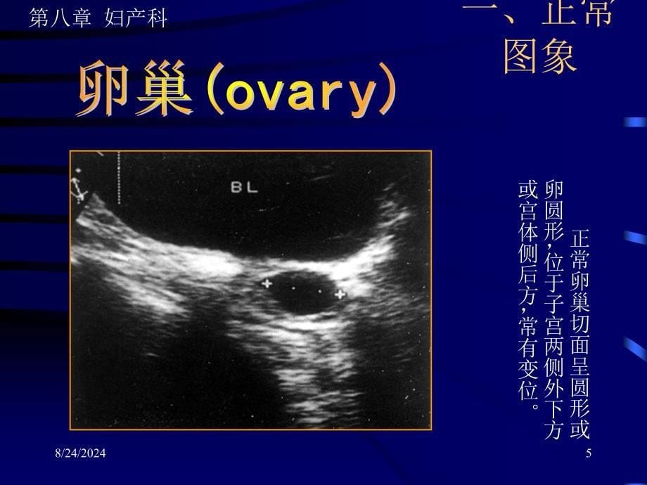 《妇产超声》PPT课件.ppt_第5页