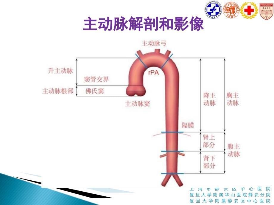 ESC主动脉疾病诊断及治疗_第5页