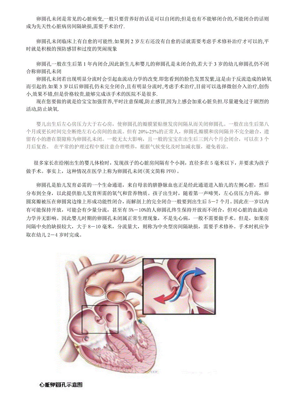 卵圆孔未闭是常见的心脏病变.doc_第1页