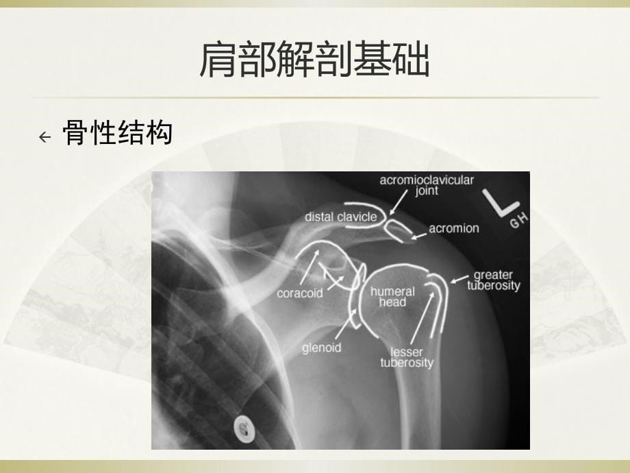 肩关节周围炎课件_第5页