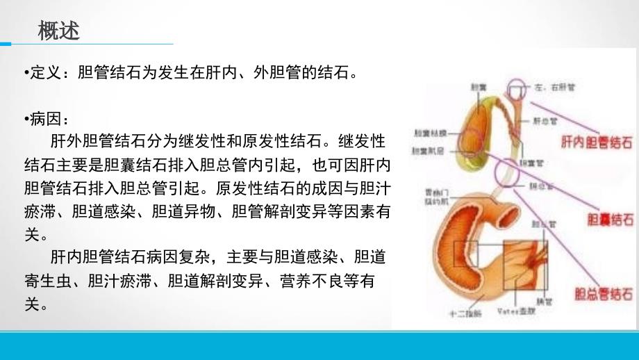 胆管结石护理查房_第3页