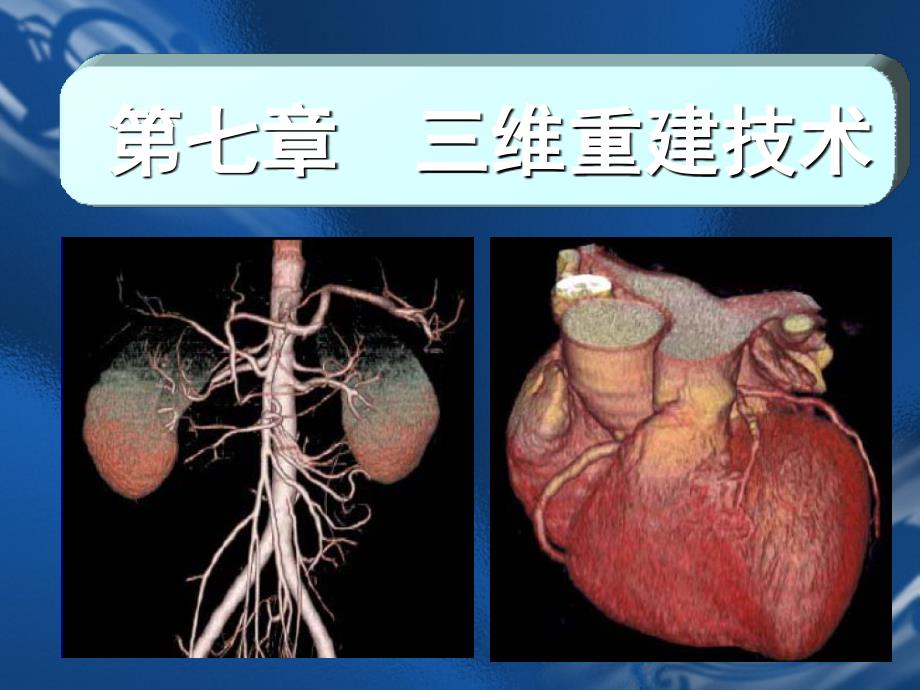 医学成像技术第八章-三维重建技术.ppt_第1页