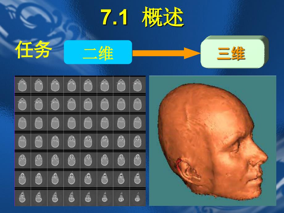 医学成像技术第八章-三维重建技术.ppt_第2页