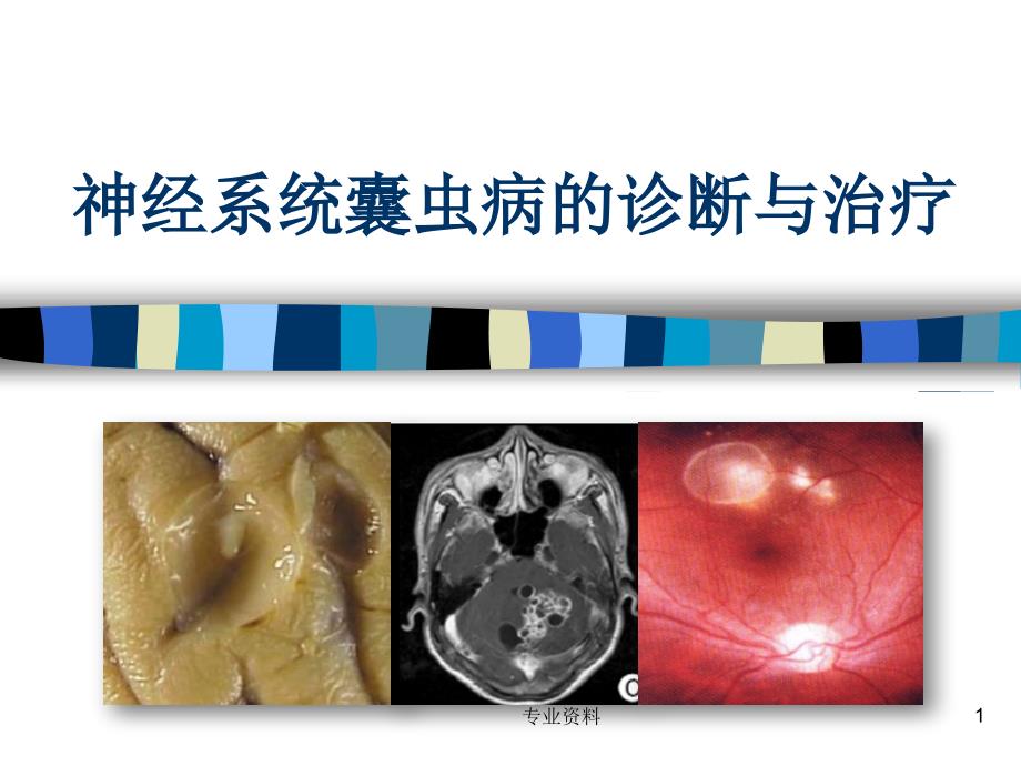 神经系统囊虫病的诊断和治疗优质材料_第1页