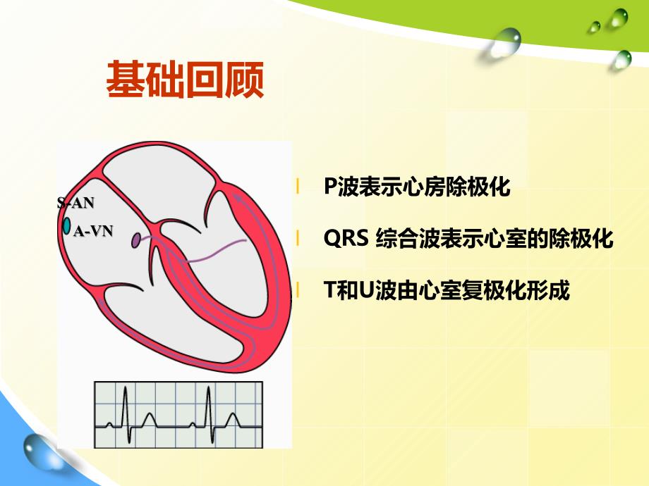 常见心脏疾病心电图表现_第3页