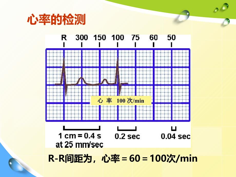 常见心脏疾病心电图表现_第5页