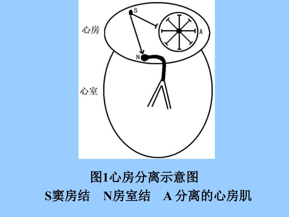 心房分离与心室分离_第3页